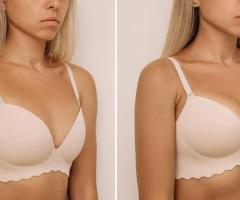 Understanding Breast Lift Surgery