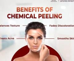 best Birthmark removal laser treatment in india