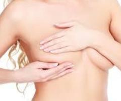 Top Breast Lift Surgeon in San Francisco | Natural, Youthful Results