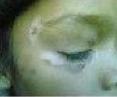 AROGYAM PURE HERBS KIT FOR VITILIGO
