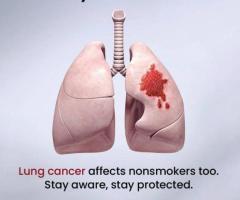 Robotic Thoracic Cancer Surgeon in Ahmedabad, India: Superior Outcomes