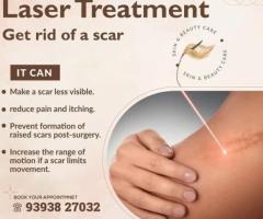 Hair Transplant Treatment in india