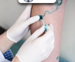 Healing Vascular Injury with Best Vascular Surgeon Gujarat, India
