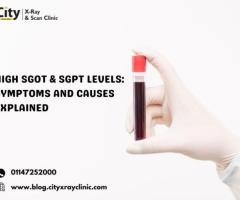 High SGOT & SGPT Levels: Symptoms and Causes Explained