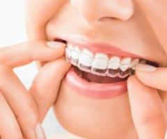 Orthodontic | Orthodontic Treatments in Pimple gurav, Pune | Ekdant Dental Care