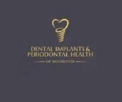 Dental Implants & Periodontal Health