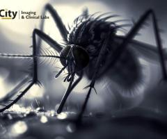 Malaria Symptoms and Blood Test Name You Should Know