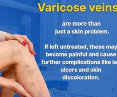 Best Vascular Surgeon in Padanthalumoodu, Kanyakumari