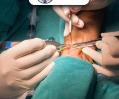 Gujarat’s Best AV Fistula Surgeon Is Here to Help