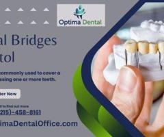 Restore Your Smile with Precision Dental Bridges in Bristol from Optima Dental Office