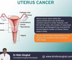 Robotic Uterus Cancer Surgery in Ahmedabad, India: Less Invasive