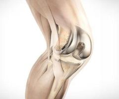 Advance Robotic Hip Replacement Surgery Doctors Kurnool | Dr. Y. HariPrasad Reddy