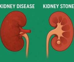 Kidney Disease vs. Kidney Stones: Key Differences and Right Specialist