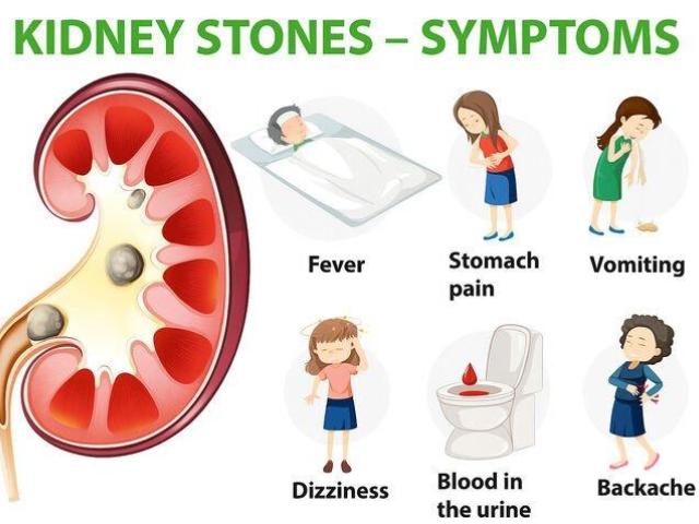 How a Kidney Stone Specialist Diagnoses and Treats Stone Pain