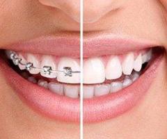 Best Dentist in Warangal