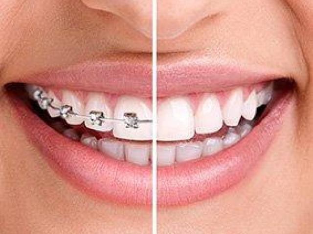 Best Dentist in Warangal