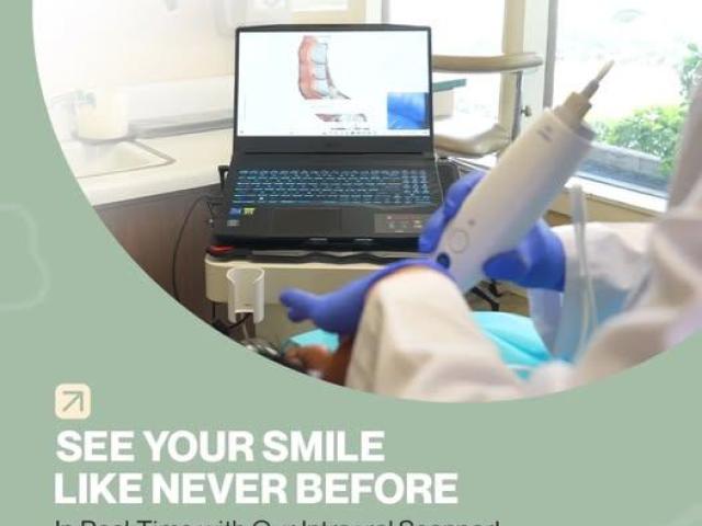 Implant Crowns Claremont