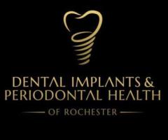 Dental Implants & Periodontal Health