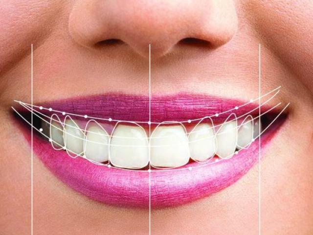 Top Notch Dental Care in Palo Alto