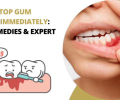 Best Dentist in Foster City, California