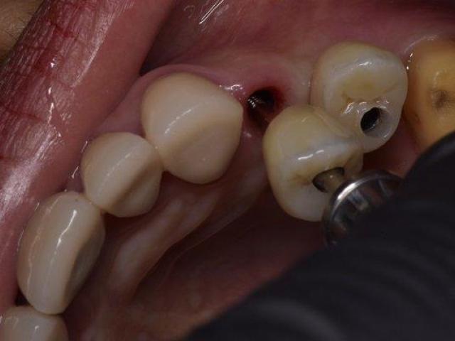 Holistic Dentist in Mexico – Natural, Biocompatible Care for Your Health and Smile