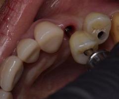 Holistic Dentist in Mexico – Natural, Biocompatible Care for Your Health and Smile