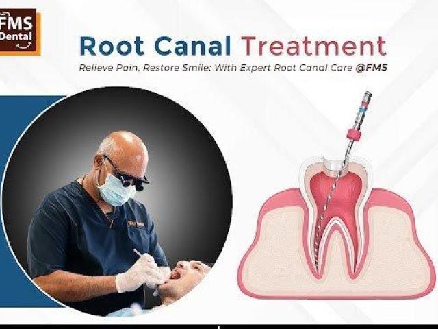 Root Canal Treatment in Hyderabad - FMS DENTAL CLINIC