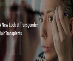 Transgender Hair Transplants In Florida