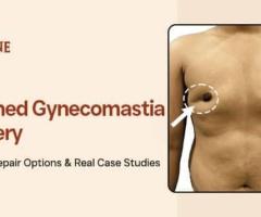 Botched Gynecomastia Surgery