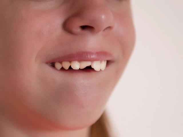 Trusted Dentist in Paddington Brisbane – Gentle & Advanced Care