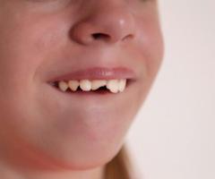 Trusted Dentist in Paddington Brisbane – Gentle & Advanced Care