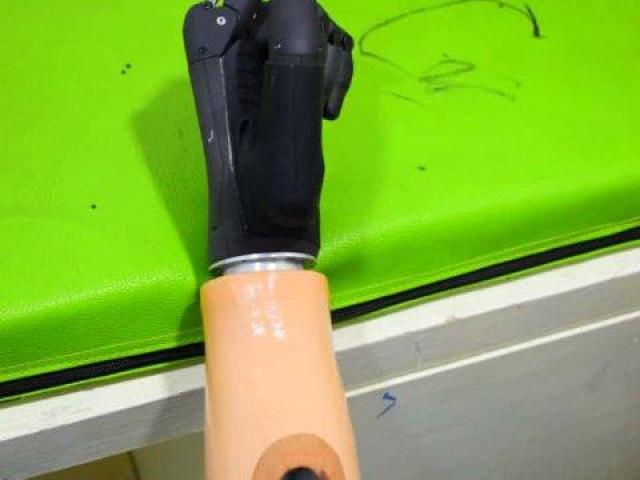 Best Artificial Leg  in Hyderabad | CareVale Prosthetics
