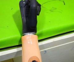 Best Artificial Leg  in Hyderabad | CareVale Prosthetics