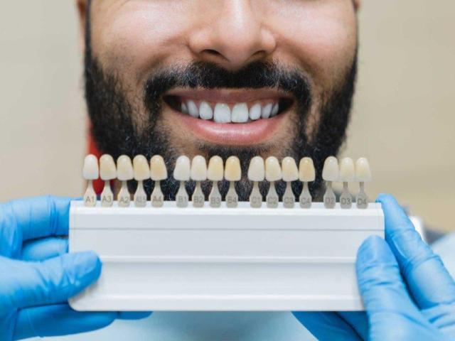 Find minimally invasive Veneers in Tijuana with ultra-thin custom-made shells