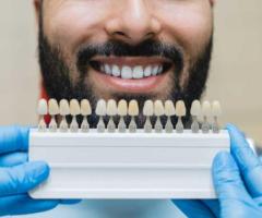 Find minimally invasive Veneers in Tijuana with ultra-thin custom-made shells