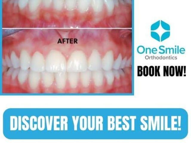 Growth guidance orthodontist/tics