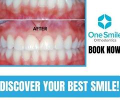 Growth guidance orthodontist/tics