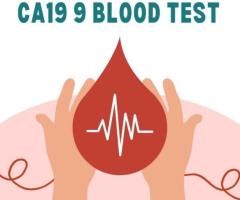 How to Check Accurate CA19 9 Blood Test Price with vrhealthy