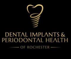 Dental Implants & Periodontal Health