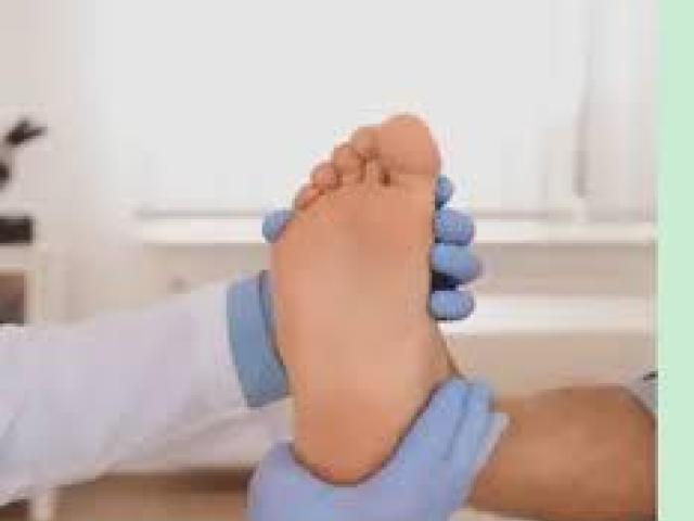 Bunion Specialist South Amboy