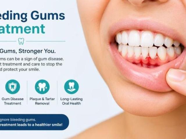 Restore Healthy Smiles with Bleeding Gums Treatment in Ahmedabad | The Tooth Studio