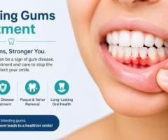 Restore Healthy Smiles with Bleeding Gums Treatment in Ahmedabad | The Tooth Studio