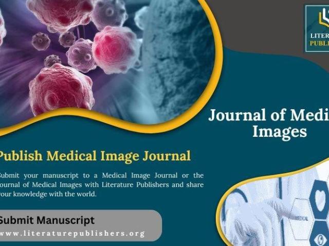 Medical Image Journal & Journal of Medical Images Literature Publishers