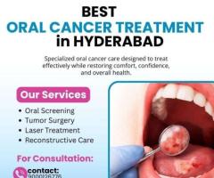 Best Oral Cancer Treatment in Hyderabad | Dr Chinnababu Sunkavalli