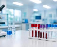 Testosterone Levels Test | Accurate Results VR Healthy