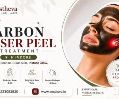 Best Carbon Laser Peel Treatment in Indore – Aestheva