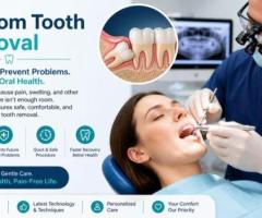 Wisdom Tooth Removal in Bopal, Ahmedabad | Gentle Care at The Tooth Studio