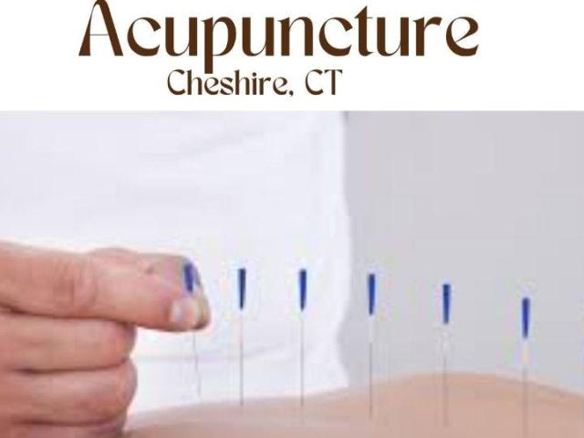Acupuncture Cheshire CT – Pain Relief & Wellness