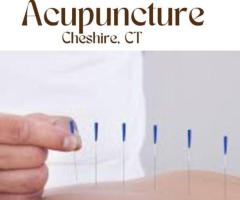 Acupuncture Cheshire CT – Pain Relief & Wellness