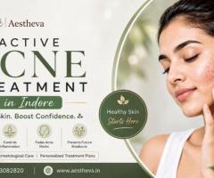 Active Acne Treatment in Indore – Aestheva